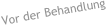 Vor der Behandlung